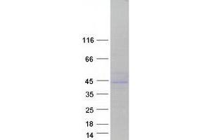 Cytochrome B5 Reductase 3 (CYB5R3) (Transcript Variant 5) protein (Myc-DYKDDDDK Tag)