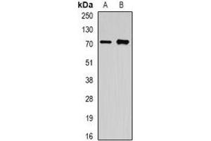 Western blot analysis of OLFM1 expression in A549 (A), mouse brain (B) whole cell lysates. (Olfactomedin 1 抗体)