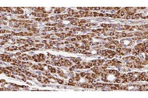 Immunohistochemistry (IHC) image for anti-Solute Carrier Family 28 (Sodium-Coupled Nucleoside Transporter), Member 1 (SLC28A1) (N-Term) antibody (ABIN6265124)