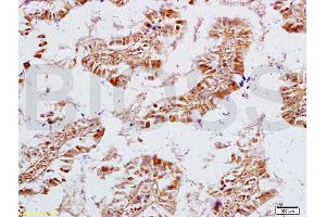 Formalin-fixed and rat intestine tissue labeled with Anti-NPY/Neuropeptide Y Polyclonal Antibody, Unconjugated (ABIN673134) at 1:200 followed by conjugation to the secondary antibody and DAB staining (ECE1 抗体  (AA 665-770))