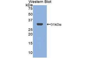 Western Blotting (WB) image for anti-B-Cell Linker (BLNK) (AA 65-314) antibody (ABIN1858143) (B-Cell Linker 抗体  (AA 65-314))