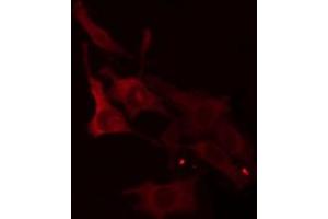 ABIN6266943 staining Hela cells by IF/ICC. (ELOVL1 抗体  (Internal Region))