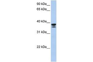 WB Suggested Anti-LGALS9 Antibody Titration: 0. (Galectin 9 抗体  (Middle Region))