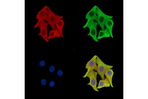 ABIN7096274 and ABIN7100336 staining Hela cells by IF/ICC. (FBXO11 抗体)