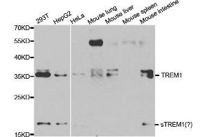 Western blot analysis of extracts of various cell lines, using TREM1 antibody. (TREM1 抗体  (AA 21-130))
