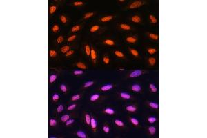 Immunofluorescence analysis of U2OS cells using KB Rabbit pAb (ABIN1680550, ABIN3015032, ABIN3015033, ABIN5663568 and ABIN6213605) at dilution of 1:100. (KAT2B 抗体  (AA 583-832))