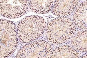 Immunohistochemistry analysis of paraffin-embedded mouse testis using,PARC (ABIN7073606) at dilution of 1: 1200 (CUL9 抗体)