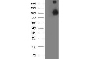 HEK293T cells were transfected with the pCMV6-ENTRY control (Left lane) or pCMV6-ENTRY ANAPC2 (Right lane) cDNA for 48 hrs and lysed. (ANAPC2 抗体)