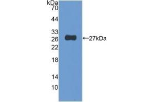 Detection of Recombinant NUP155, Human using Polyclonal Antibody to Nucleoporin 155 (NUP155) (NUP155 抗体  (AA 1154-1379))