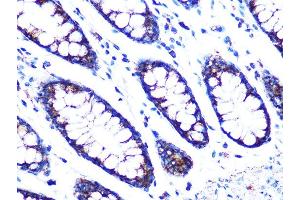 Immunohistochemistry of paraffin-embedded human colon using PDK2 Rabbit mAb (ABIN7269773) at dilution of 1:100 (40x lens). (PDK2 抗体)