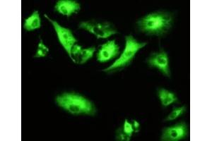 Detection of RNPEP in A549 cells using Polyclonal Antibody to Aminopeptidase B (RNPEP) (RNPEP 抗体  (AA 388-616))