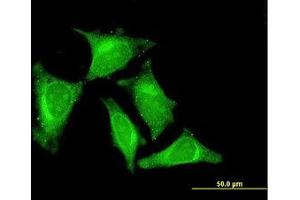 Image no. 3 for anti-RasGEF Domain Family, Member 1C (RASGEF1C) (AA 168-261) antibody (ABIN599341) (RASGEF1C 抗体  (AA 168-261))