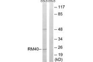 Western blot analysis of extracts from COLO cells, using MRPL40 Antibody.