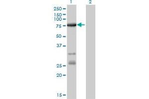 Western Blotting (WB) image for anti-Acyl-CoA Synthetase Long-Chain Family Member 5 (ACSL5) (AA 91-187) antibody (ABIN599251) (ACSL5 抗体  (AA 91-187))