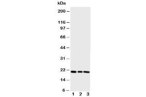 Western blot testing of PBP antibody and Lane 1:  rat brain (PEBP1 抗体  (N-Term))
