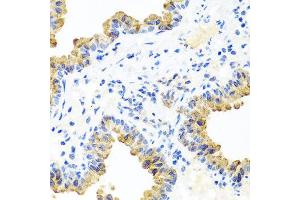 Immunohistochemistry of paraffin-embedded mouse lung using PIP4K2B antibody at dilution of 1:100 (x40 lens). (PIP4K2B 抗体)