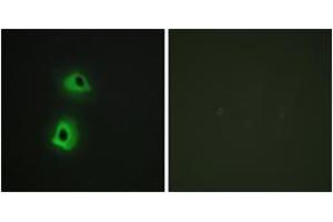 Immunofluorescence analysis of HeLa cells, using T3JAM Antibody. (TRAF3IP3 抗体  (AA 251-300))