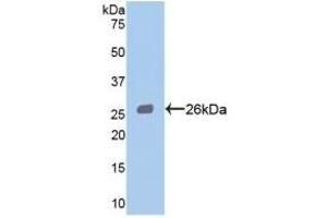 Western Blotting (WB) image for anti-Signal Transducer and Activator of Transcription 3 (Acute-Phase Response Factor) (STAT3) (AA 335-546) antibody (ABIN7444046)