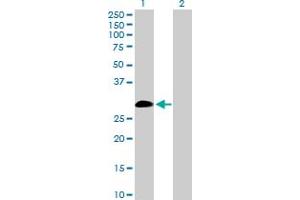 Western Blot analysis of IL9 expression in transfected 293T cell line by IL9 MaxPab polyclonal antibody. (IL-9 抗体  (AA 1-144))