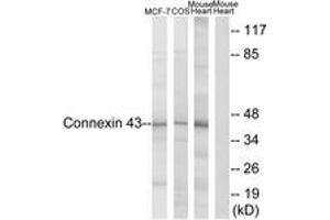 Western blot analysis of extracts from MCF-7/COS7/Mouse Heart, using Connexin 43 (Ab-367) Antibody. (Connexin 43/GJA1 抗体  (AA 332-381))