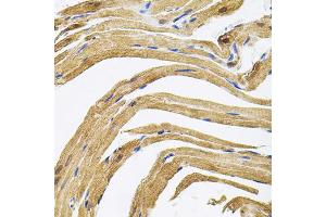 Immunohistochemistry of paraffin-embedded rat heart using CEP164 antibody. (CEP164 抗体)