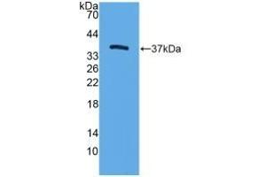 Detection of Recombinant TFF3, Mouse using Polyclonal Antibody to Trefoil Factor 3 (TFF3) (TFF3 抗体  (AA 23-81))
