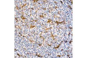 Immunohistochemistry of paraffin-embedded Human tonsil (positive control antibody staining, clone 55k-2) using Fascin/FSCN1 antibody (ABIN7267142) at dilution of 1:100 (40x lens). (Fascin 抗体)