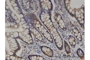 Image no. 2 for anti-Arginyl-tRNA Synthetase (RARS) (AA 1-661) antibody (ABIN599427) (RARS 抗体  (AA 1-661))