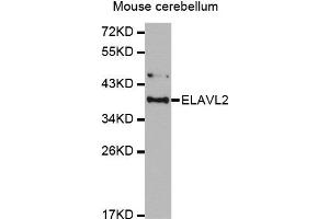 Western Blotting (WB) image for anti-ELAV (Embryonic Lethal, Abnormal Vision, Drosophila)-Like 2 (Hu Antigen B) (ELAVL2) antibody (ABIN1876947) (ELAVL2 抗体)