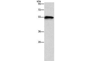 Western Blot analysis of Mouse heart tissue using CDK19 Polyclonal Antibody at dilution of 1:1000 (CDK19 抗体)