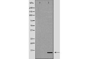 Western blot analysis of Hela whole cell lysates, using RBX1 Antibody. (RBX1 抗体  (C-Term))