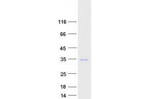 Western Blotting (WB) image for RAB23, Member RAS Oncogene Family (RAB23) (Transcript Variant 1) protein (Myc-DYKDDDDK Tag) (ABIN2730299)
