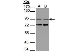 WB Image Sample(30 μg of whole cell lysate) A:293T B:Raji, 7. (NIR1 抗体  (C-Term))