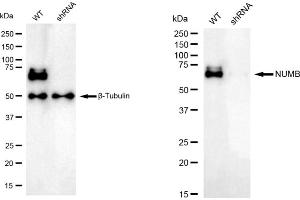 Western blotting analysis using NUMB antibody (ABIN7799692). (Recombinant NUMB 抗体)