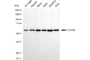Western blotting analysis using CYP7B1 antibody (ABIN7798259).