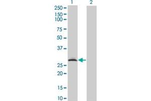 Western Blot analysis of RAD1 expression in transfected 293T cell line by RAD1 monoclonal antibody (M01A), clone 1G2. (RAD1 抗体  (AA 1-90))