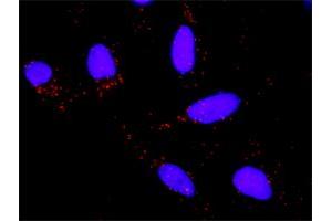 Proximity Ligation Analysis of protein-protein interactions between TP53 and HSPA1B. (HSPA1B 抗体  (AA 531-611))