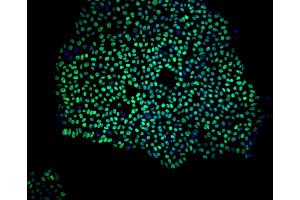 Immunoflourescent staining of Nanog in human embryonic stem cells.