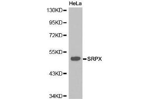 Western Blotting (WB) image for anti-Sushi-Repeat Containing Protein, X-Linked (SRPX) (AA 40-320) antibody (ABIN6215763) (SRPX 抗体  (AA 40-320))