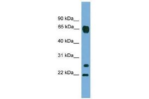 MMP26 antibody used at 0. (MMP26 抗体  (C-Term))