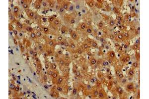 Immunohistochemistry analysis of paraffin-embedded human liver tissue using ISCA1 Antibody at a dilution of 1/100. (ISCA1 抗体  (AA 67-122))