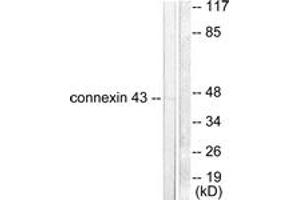 Western blot analysis of extracts from A549 cells, using Connexin 43 Antibody. (Connexin 43/GJA1 抗体  (AA 333-382))