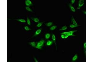 Immunofluorescent analysis of Hela cells using ABIN7168329 at dilution of 1:100 and Alexa Fluor 488-congugated AffiniPure Goat Anti-Rabbit IgG(H+L) (RNA Binding Motif Protein, Y Chromosome (RBMY) (AA 501-700) 抗体)