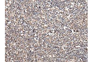 The image on the left is immunohistochemistry of paraffin-embedded Human tonsil tissue using ABIN7128064(UGGT2 Antibody) at dilution 1/20, on the right is treated with fusion protein. (UGCGL2 抗体)