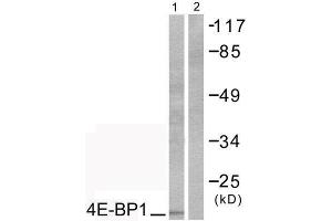 Western Blotting (WB) image for anti-Eukaryotic Translation Initiation Factor 4E Binding Protein 1 (EIF4EBP1) (Thr70) antibody (ABIN1847930)