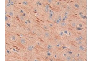 #VALUE! (MEPE 抗体  (AA 28-224))