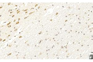 Immunohistochemistry (IHC) image for anti-Leucine Rich Repeat and Ig Domain Containing 1 (LINGO1) (AA 575-603), (C-Term) antibody (ABIN651289)