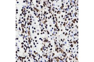 Immunohistochemistry (IHC) image for anti-High Mobility Group Box 1 (HMGB1) (AA 100-200) antibody (ABIN3023358) (HMGB1 抗体  (AA 100-200))