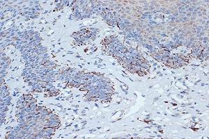Immunohistochemistry of paraffin-embedded human esophageal using STK3/MST2 Rabbit mAb (ABIN7270223) at dilution of 1:100 (40x lens). (STK3 抗体)