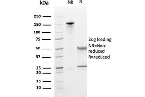 SDS-PAGE Analysis Purified CD5 Mouse Monoclonal Antibody (CD5/2419). (CD5 抗体  (AA 269-366))